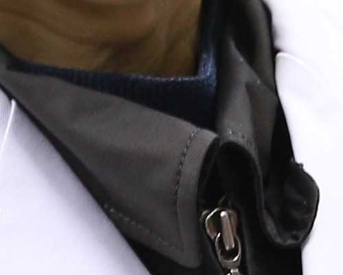 太早过晚都不行,羊水穿刺最合适的检查时间别错过