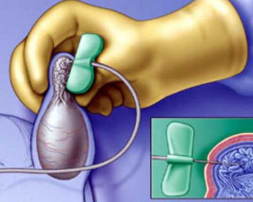 海外代孕地址_代孕公司官网网站,做到这几件事,改善子宫内膜异位症