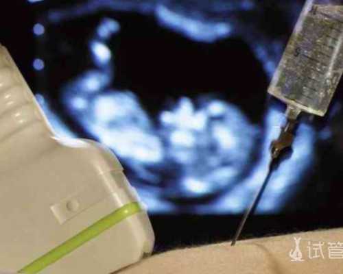 智力与脑勺扁平:是智商的晴雨表,还是只是一个无关紧要的特征?