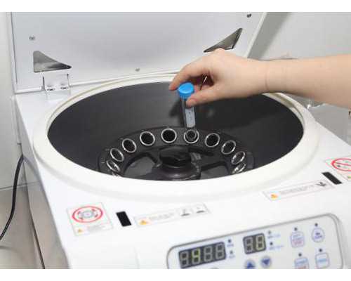 供卵代孕检查碰到炎症怎么办 做供卵代孕有炎症影响着床吗