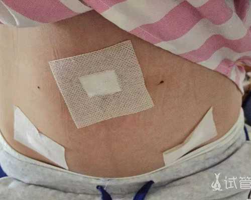 内分泌紊乱的8个征兆，你需要知道